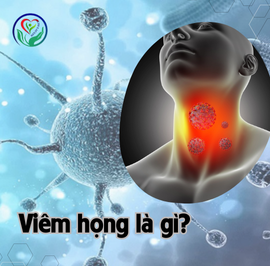 Pharyngitis: Causes, Symptoms, and Effective Prevention Methods